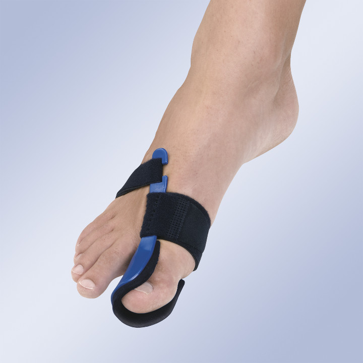 Hallux valgus